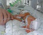 Baby on intensive care